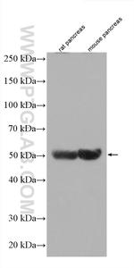 GLP1R Antibody in Western Blot (WB)