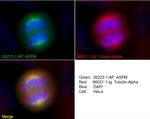 ASPM Antibody in Immunocytochemistry (ICC/IF)