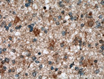 ASPM Antibody in Immunohistochemistry (Paraffin) (IHC (P))