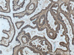 ASPM Antibody in Immunohistochemistry (Paraffin) (IHC (P))