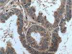 ASPM Antibody in Immunohistochemistry (Paraffin) (IHC (P))