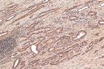 ASPM Antibody in Immunohistochemistry (Paraffin) (IHC (P))