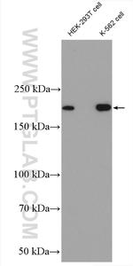 ASPM Antibody in Western Blot (WB)