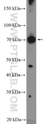 PATZ1 Antibody in Western Blot (WB)