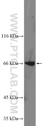 EDEM1 Antibody in Western Blot (WB)