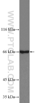 EDEM1 Antibody in Western Blot (WB)