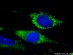 WNT10A Antibody in Immunocytochemistry (ICC/IF)