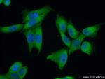 ZC3H15 Antibody in Immunocytochemistry (ICC/IF)