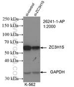 ZC3H15 Antibody in Western Blot (WB)