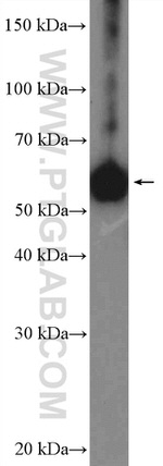 ZC3H15 Antibody in Western Blot (WB)