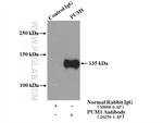 PUM1 Antibody in Immunoprecipitation (IP)