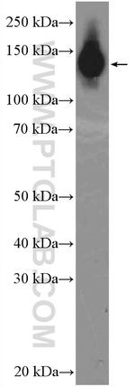 PUM1 Antibody in Western Blot (WB)