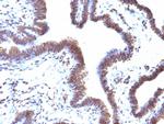 EMI1 (Early Mitotic Inhibitor-1) Antibody in Immunohistochemistry (Paraffin) (IHC (P))