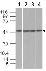 EMI1 (Early Mitotic Inhibitor-1) Antibody in Western Blot (WB)