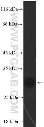 CBX7 Antibody in Western Blot (WB)