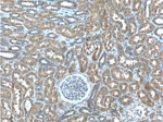 C8orf4 Antibody in Immunohistochemistry (Paraffin) (IHC (P))