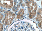 C8orf4 Antibody in Immunohistochemistry (Paraffin) (IHC (P))