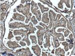 C8orf4 Antibody in Immunohistochemistry (Paraffin) (IHC (P))