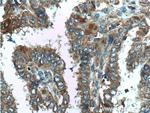 C8orf4 Antibody in Immunohistochemistry (Paraffin) (IHC (P))