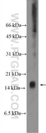 C8orf4 Antibody in Western Blot (WB)