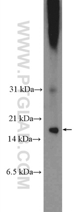 C8orf4 Antibody in Western Blot (WB)