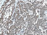 DALRD3 Antibody in Immunohistochemistry (Paraffin) (IHC (P))