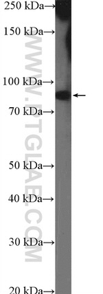 CCDC21 Antibody in Western Blot (WB)