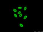 ZNF828 Antibody in Immunocytochemistry (ICC/IF)