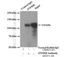 ZNF828 Antibody in Immunoprecipitation (IP)