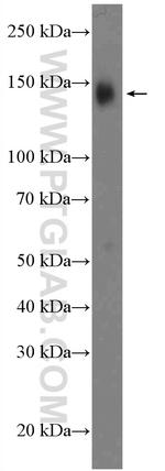 ZNF828 Antibody in Western Blot (WB)