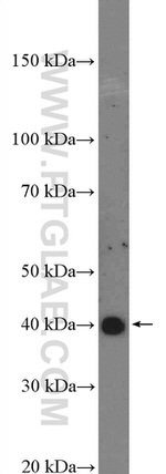 C10orf46 Antibody in Western Blot (WB)