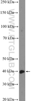 C10orf46 Antibody in Western Blot (WB)