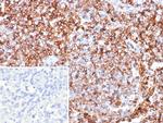 GBP1 Antibody in Immunohistochemistry (Paraffin) (IHC (P))