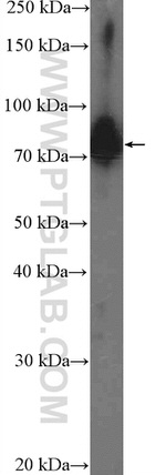 C19orf21 Antibody in Western Blot (WB)