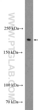 Neurofascin Antibody in Western Blot (WB)