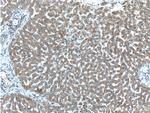 F2R Antibody in Immunohistochemistry (Paraffin) (IHC (P))