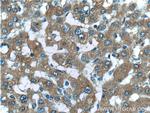 F2R Antibody in Immunohistochemistry (Paraffin) (IHC (P))