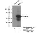 RBCK1 Antibody in Immunoprecipitation (IP)