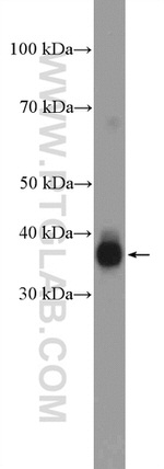 GTF3C6 Antibody in Western Blot (WB)