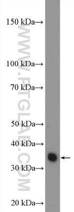 GTF3C6 Antibody in Western Blot (WB)