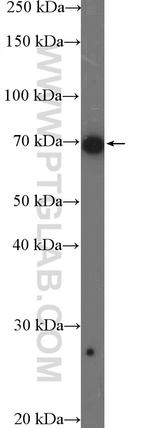 DDX5 Antibody in Western Blot (WB)