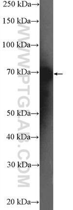 DDX5 Antibody in Western Blot (WB)