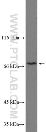 SLC5A6 Antibody in Western Blot (WB)