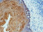 pan-keratin Antibody in Immunohistochemistry (Paraffin) (IHC (P))