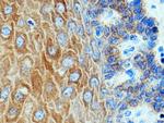 pan-keratin Antibody in Immunohistochemistry (Paraffin) (IHC (P))