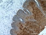 pan-keratin Antibody in Immunohistochemistry (Paraffin) (IHC (P))