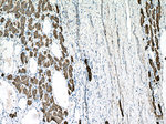 pan-keratin Antibody in Immunohistochemistry (Paraffin) (IHC (P))