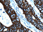 pan-keratin Antibody in Immunohistochemistry (Paraffin) (IHC (P))