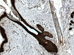 pan-keratin Antibody in Immunohistochemistry (Paraffin) (IHC (P))