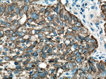 pan-keratin Antibody in Immunohistochemistry (Paraffin) (IHC (P))